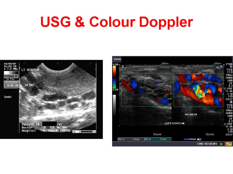 USG & Colour Doppler